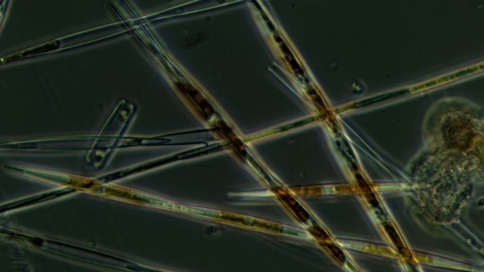 Phytoplankton, like this microscopic species called Pseudo-nitzschia, are so small that they are invisible to the naked eye. Image from NOAA.